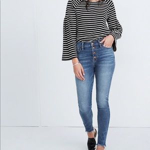 Madewell High-Rise Skinny Jeans: Button-Front